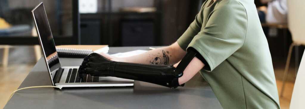 close up of person with prosthetic arm working at a computer in an office